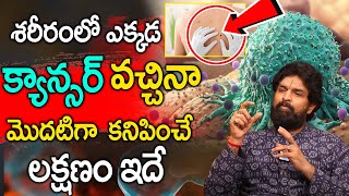 ఒంట్లో కాన్సర్ కణాలు ఉంటె కనిపించే సూచనలు || Vikramaditya About Cancer || iD Health 360