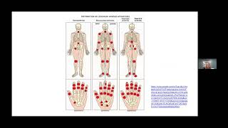 Wellness Webinar: Understanding Arthritis & Joint Pain