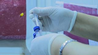 SF losing $8 million in HIV grant funding, impacting treatment and prevention services