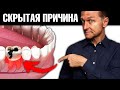 Скрытая причина инфаркта, о которой вы точно не знали...