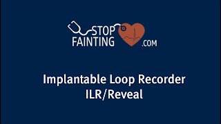 Implantable Loop Recorder