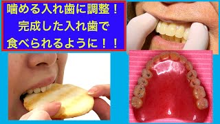 入れ歯完成！お口と調和させて、ばっちり食べられる入れ歯にする方法とは！？