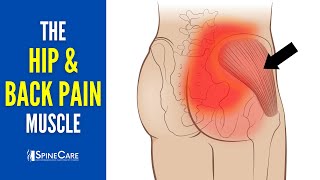 The Lower Back and Hip Pain Muscle (How to Release It for INSTANT RELIEF)