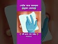 পেটে মাকড়সার ঢুকে লোকটির একি হলো 3danimation shorts