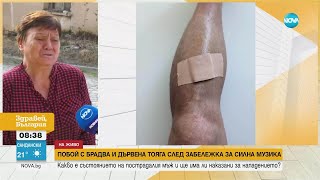 След забележка за силна музика: Нападнаха мъж с брадва и тояга в берковско село