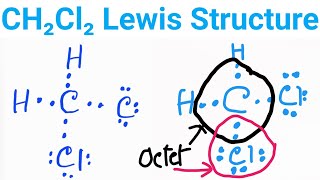 CH2Cl2 Lewis Structure|| Lewis Dot Structure for CH2Cl2 ||Dichloro Methane Lewis Structure