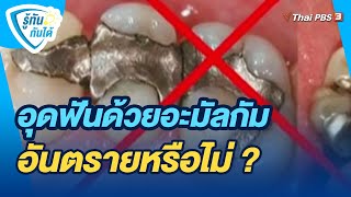 อุดฟันด้วยอะมัลกัมอันตรายหรือไม่ ? | รู้ทันกันได้