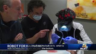 Experience the Precision and Innovation of the Artas Robot iXi for Hair Transplants (2023)