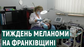 Прикарпатцям пропонують дистанційно пройти обстеження на наявність меланоми