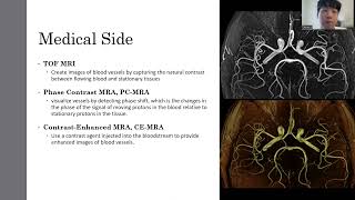 Vessel segmentation in MRI For EE432 in Northwestern University