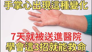 手掌心出現這種變化，7天就被送進醫院了，學會這3招就能避免 ，65歲以上必看！【中老年講堂】