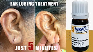 Ear Hole Repair / Ear Lobe Repair / Torn Ear Repair / Ear Pasting Lotion /Ear lobe/Hole Treatment