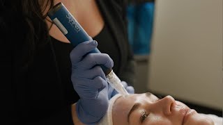 SkinPen® Microneedling \u0026 Exosomes | Elevate Your Microneedling Treatment for Total Skin Rejuvenation