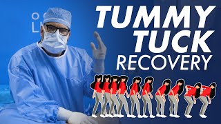 Tummy Tuck Recovery - Standing Up