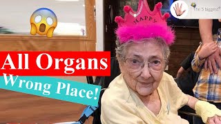 She Lived 99 Years With Her Organs in The Wrong Places ❌❌❌! ~ Body Bizarre!