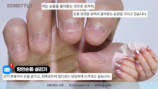 Eng sub) She bit her nails for 18 years.