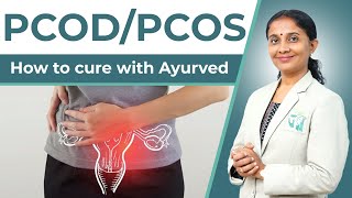 PCOD/PCOS - क्या होता है? | All about PCOD/PCOS- Causes, Symptoms & Treatment | Dr. Devangi Jogal |