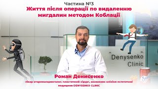 Харчування, спорт та інші рекомендації після видалення мигдалин коблатором