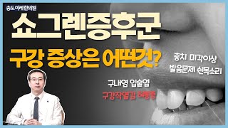 쇼그렌증후군 증상 구강내 발생하는 것은? 구내염 구강작열감 혀통증 위축 구순염 구취 미각이상 발음이상 등