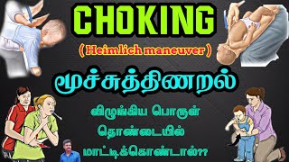 மூச்சுத்திணறல்|Choking|Heimlich maneuver|குழந்தைகள் எதையாவது விழுங்கிவிட்டால் என்ன செய்யவேண்டும்