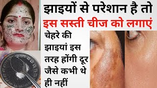 कितनी भी पुरानी झाइयां जड़ से खत्म करें \\ How To Remove Pigmentation