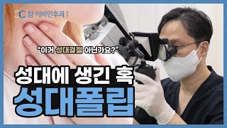 [성대폴립]성대에 생긴 혹에 대해 알아봅니다