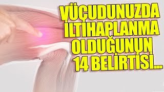 Vücudunuzda İltihaplanma Olduğunun 14 Belirtisi...