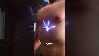 How A Taser Works