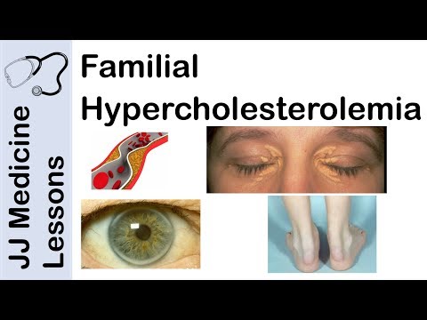 What genetic abnormalities can result in familial hypercholesterolaemia?