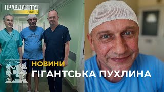 Медики Львова видалили чоловіку, який готувався їхати на фронт, гігантську пухлину