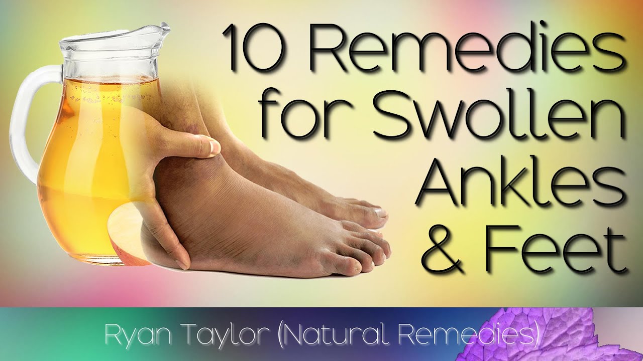 10 Home Remedies For: Swollen Feet And Ankles - YouTube