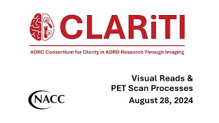 CLARiTI Webinar: Visual Reads and PET Scan Processes - August 28, 2024