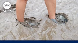 Woman speaks out after sinking into quicksand