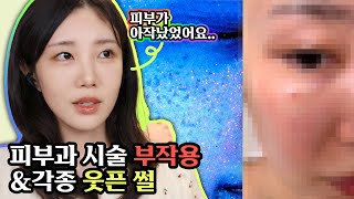 아무도 알려주지 않았던 리프팅 부작용..💧추천/비추천시술/웃픈 썰 모음