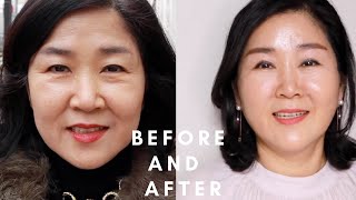 Jina Kim's Mom's Amazing Plastic Surgery Transformation | Seoul Guide Medical