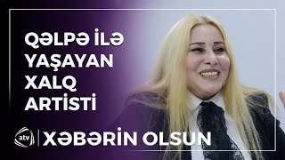 100-dən çox qəlpə ilə yaşayan Xalq artisti / Xəbərin olsun