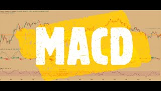 The Ultimate Trading Indicator - MACD