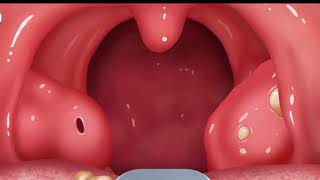ASMR dental treatment animation | satisfying tartar and caries removel