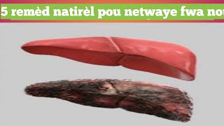 5 remèd natirèl pou netwaye fwa nou