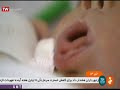 تاثیر مثبت ضربه زدن آهسته eft بر روی بدن نوزادان و بزرگسالان