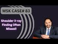 MSK CASE #83- Shoulder X-Ray You Will Not Believe!