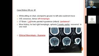 Clinical localisation of Stroke-Dr HV srinivas