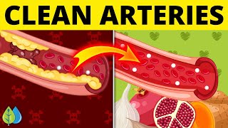 ❣️Top 7 Foods that Unclog Arteries Naturally and Prevent Heart Attack