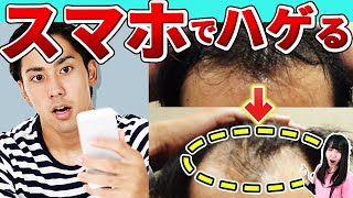 【結論】ハゲたくないなら知っておきたい！スマホで薄毛になる3 つの理由と対策を徹底解説