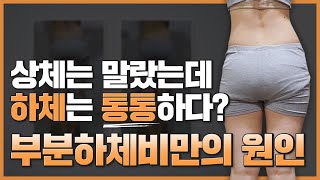 [사진확인] 상체는 마르고 하체는 통통? 골반틀어짐이 만든 부분하체비만