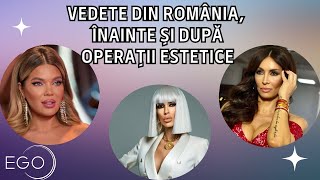 Vedete din România, înainte și după operații estetice. Gina Pistol s-a operat de 4 ori la nas și...