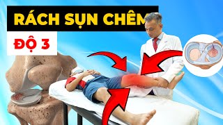 Tổn Thương Sụn Chêm Trong Độ 3: Đau Đớn Tột Cùng & Giải Pháp Điều Trị | Y học Thể thao Starsmec