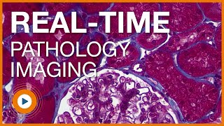 Clinical Pathology Microscope Video