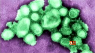 Developing a Universal Influenza Vaccine