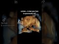 4D Ultrasound Video of Baby at 35 Weeks 2 Days Pregnant